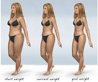 Gastric Band Hypnosis Weight Loss 647362 Image 0